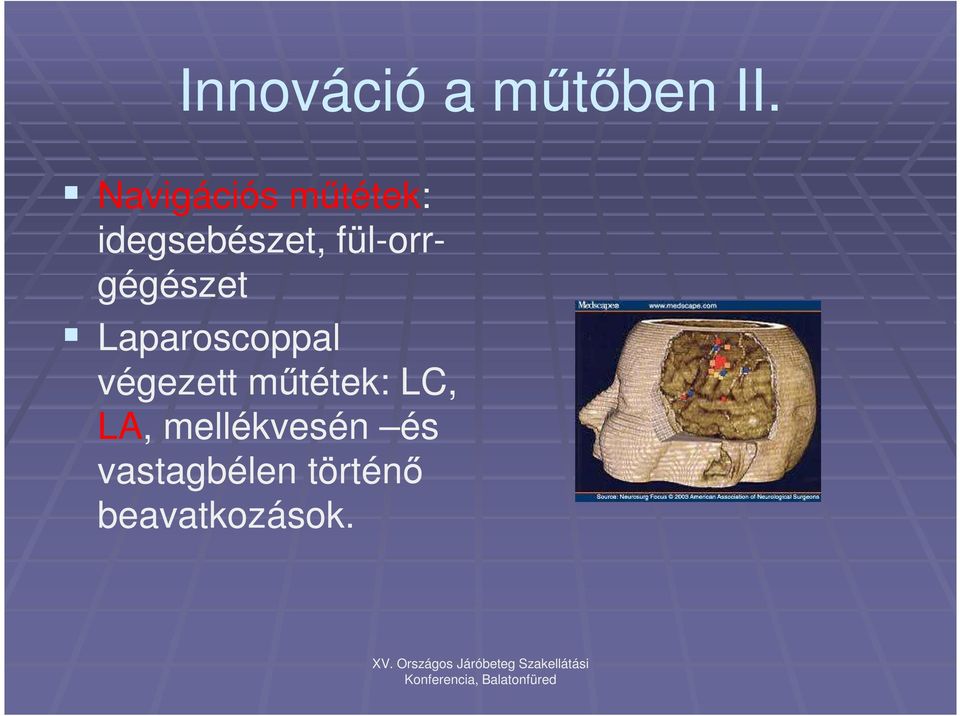 fül-orrgégészet Laparoscoppal végezett