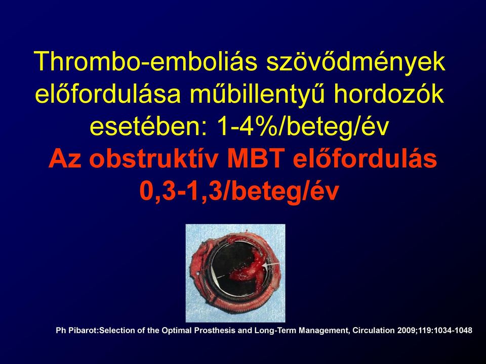 előfordulás 0,3-1,3/beteg/év Ph Pibarot:Selection of the