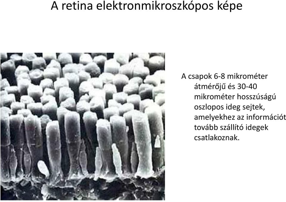 hosszúságú oszlopos ideg sejtek, amelyekhez