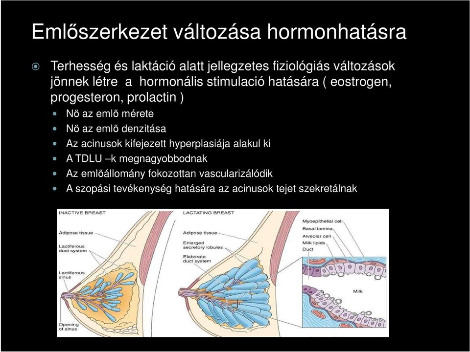 mérete Nő az emlő denzitása Az acinusok kifejezett hyperplasiája alakul ki A TDLU k megnagyobbodnak