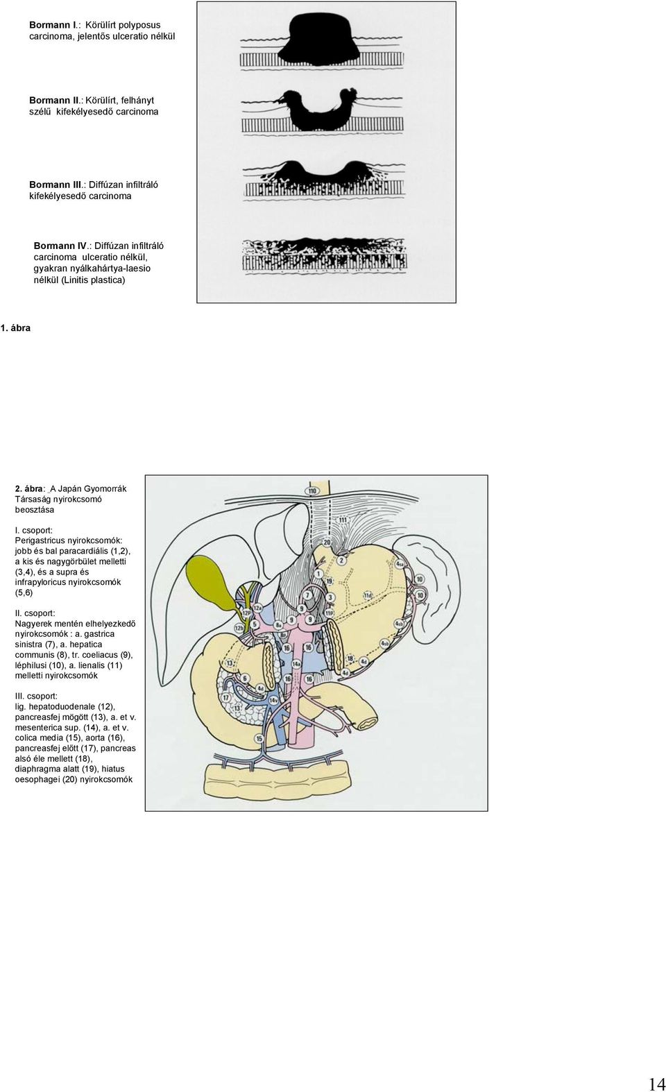 csoport: Perigastricus nyirokcsomók: jobb és bal paracardiális (1,2), a kis és nagygörbület melletti (3,4), és a supra és infrapyloricus nyirokcsomók (5,6) II.