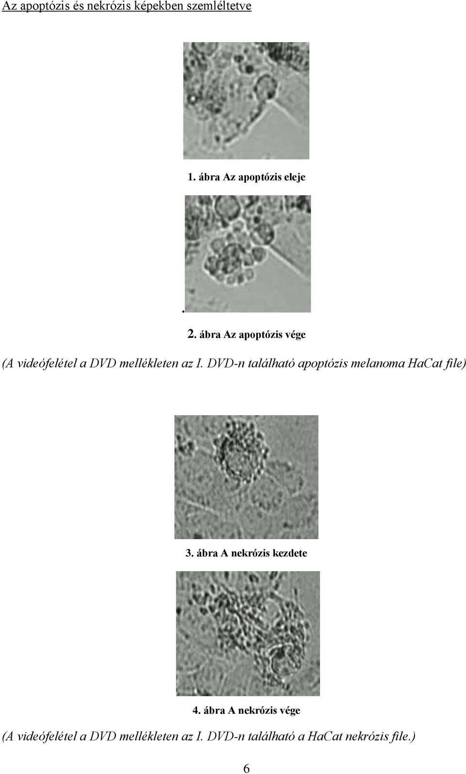 DVD-n található apoptózis melanoma HaCat file) 3. ábra A nekrózis kezdete 4.