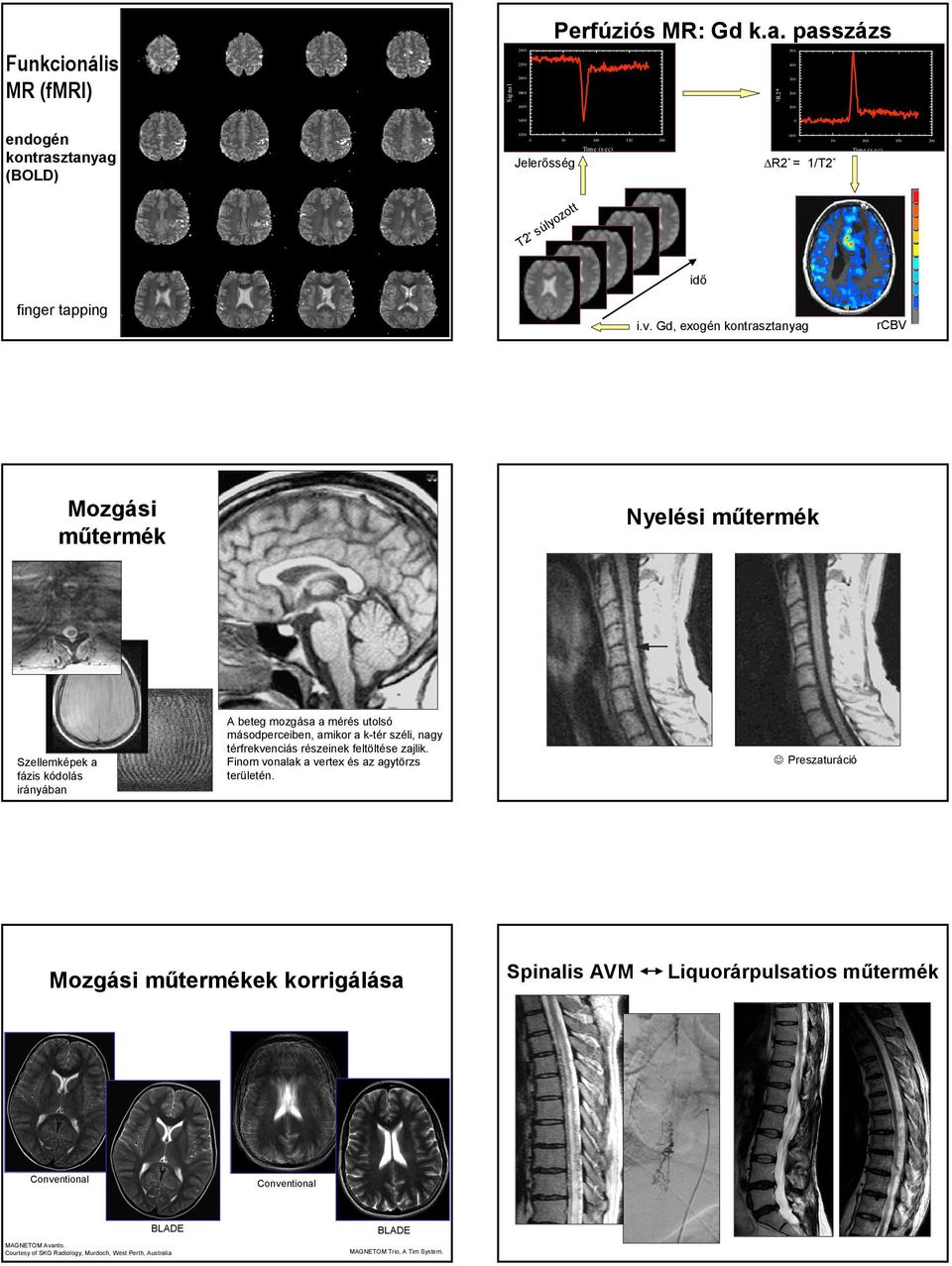 passzázs signal_2233 signal_2233 500 400 300 200 ²R2* 100 endogén kontrasztanyag (BOLD) 1400 1200 0 50 100 150 200 Tim e (s ec) Jelerősség 0-100 0 50 100 150 200 Time (s ec) R2 * = 1/T2 * T2 *
