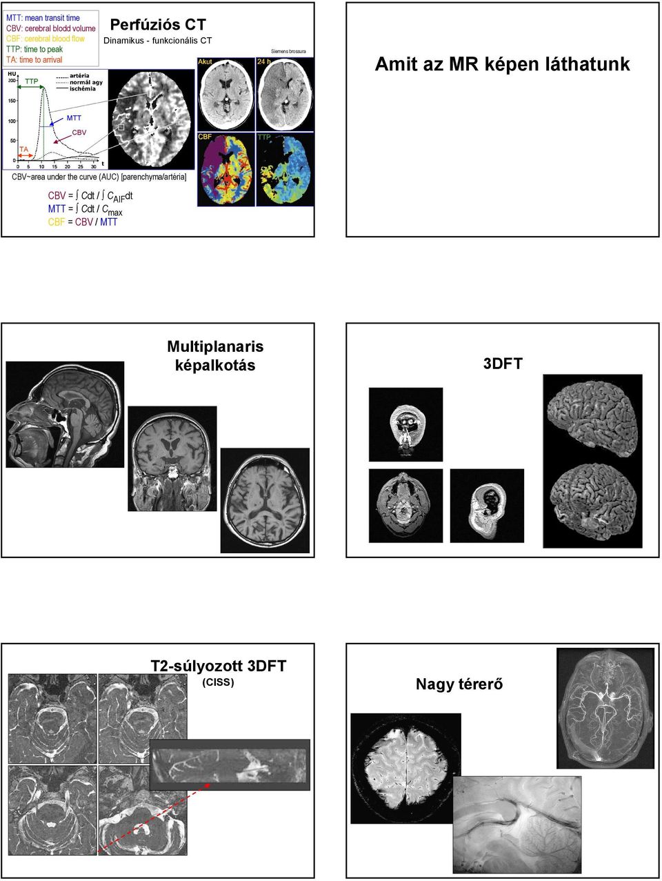 képen láthatunk MTT TA CBV CBF TTP CBV~area under the curve (AUC) [parenchyma/artéria] CBV = Cdt / C