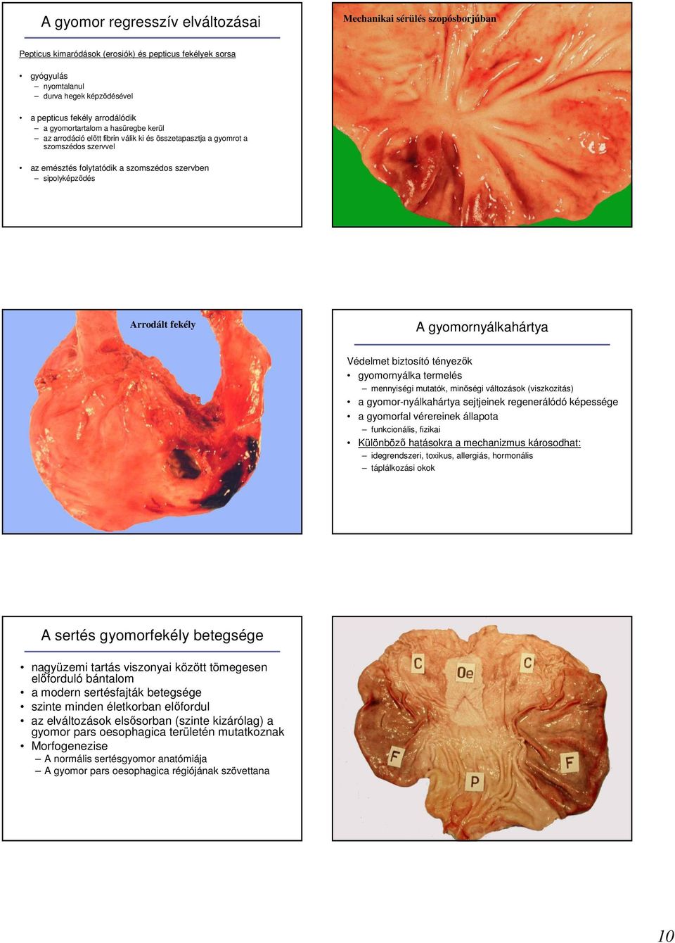 Arrodált fekély A gyomornyálkahártya Védelmet biztosító tényezık gyomornyálka termelés mennyiségi mutatók, minıségi változások (viszkozitás) a gyomor-nyálkahártya sejtjeinek regenerálódó képessége a