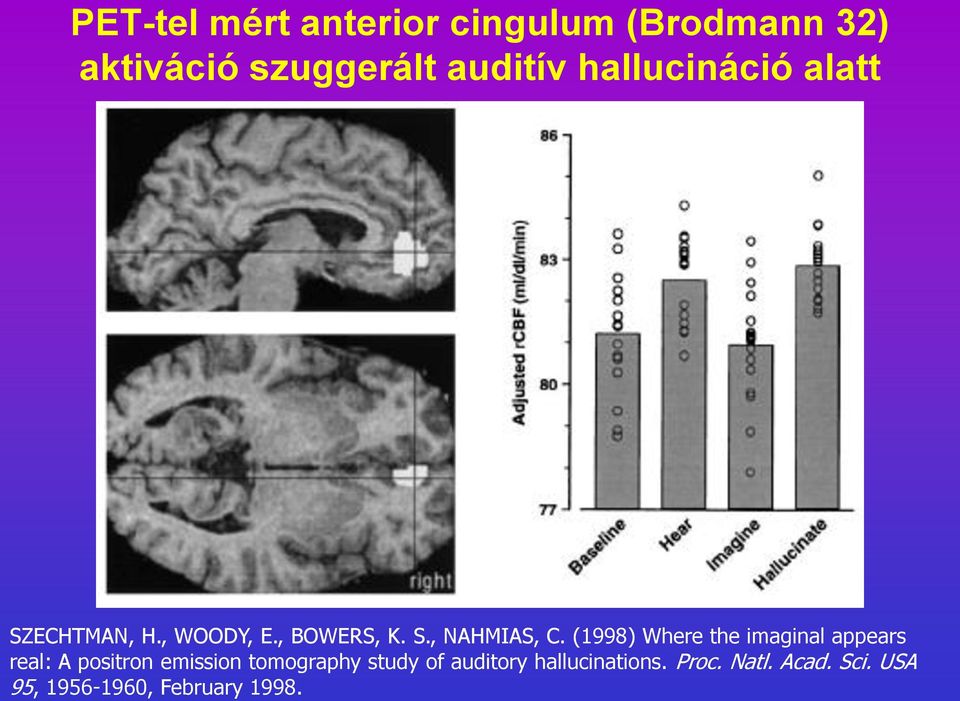 (1998) Where the imaginal appears real: A positron emission tomography study