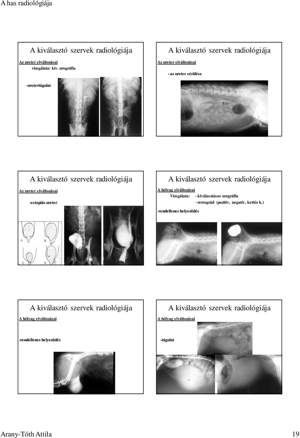 ureter elváltozásai -ectopiás ureter Vizsgálata: - kiválasztásos urográfia -