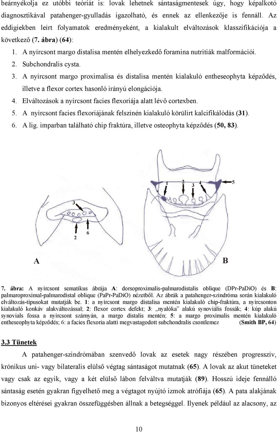 2. Subchondralis cysta. 3. A nyírcsont margo proximalisa és distalisa mentén kialakuló entheseophyta képződés, illetve a flexor cortex hasonló irányú elongációja. 4.