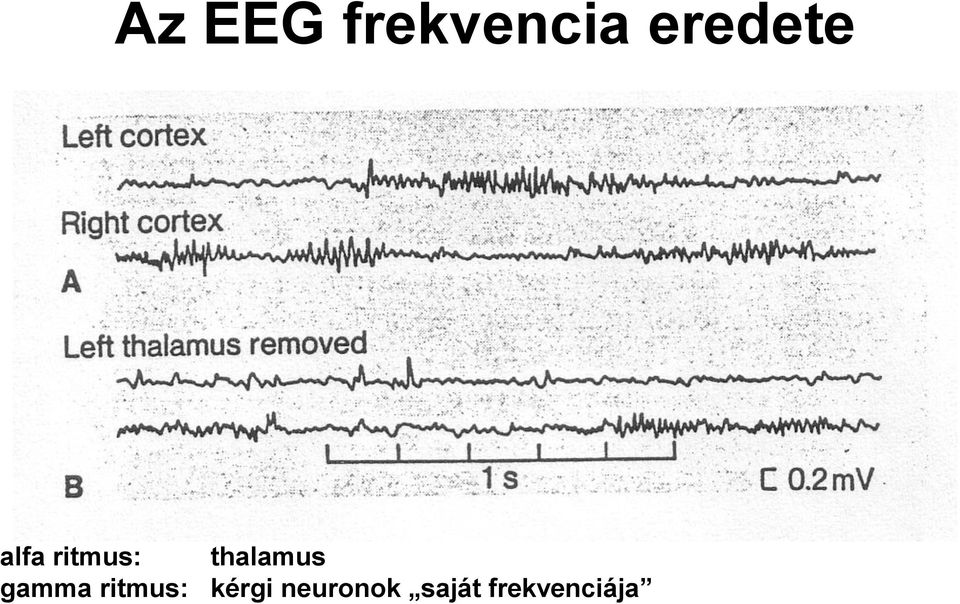 thalamus gamma ritmus: