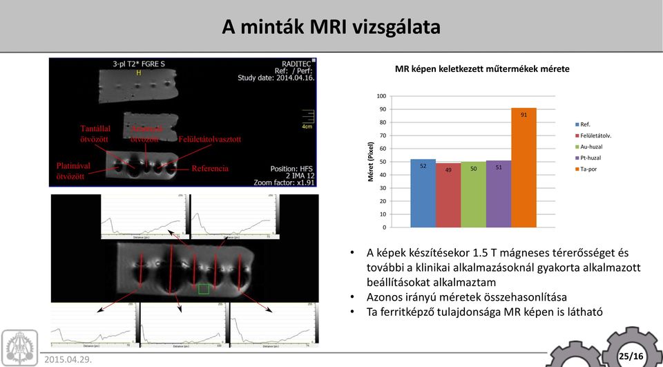 5 T mágneses térerősséget és további a klinikai alkalmazásoknál gyakorta alkalmazott beállításokat