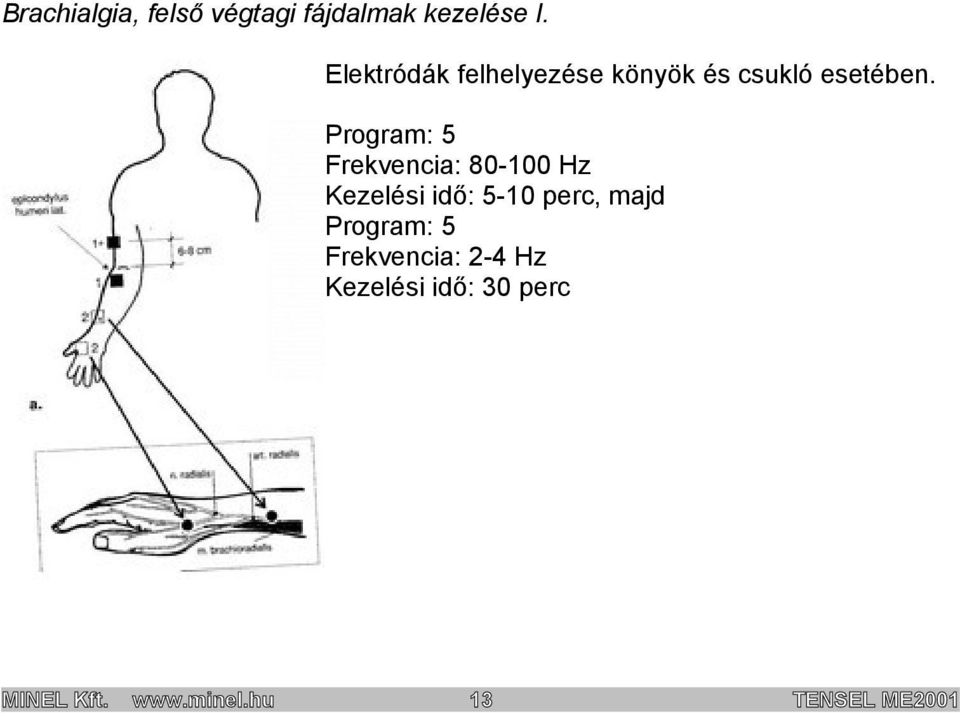 Program: 5 Frekvencia: 80-100 Hz Kezelési idő: 5-10 perc, majd