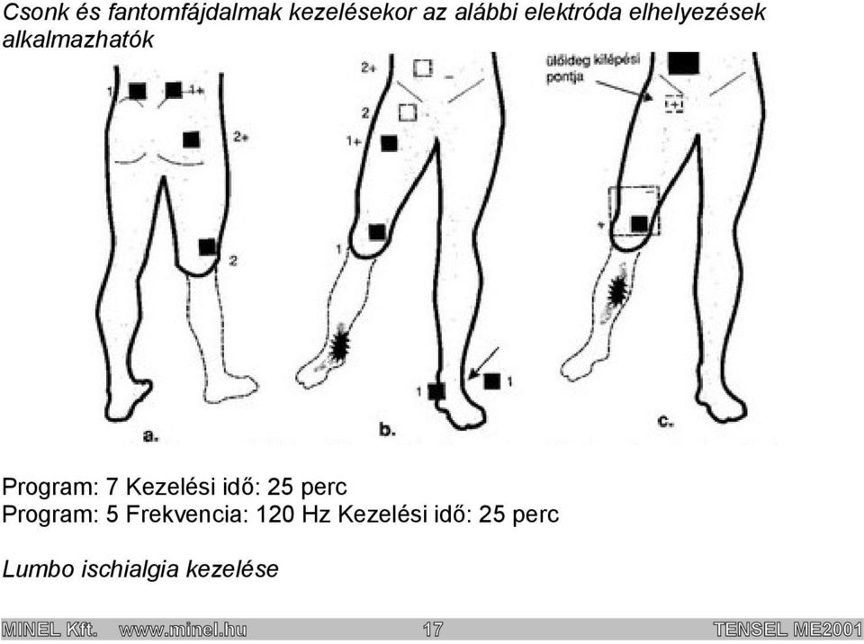 perc Program: 5 Frekvencia: 120 Hz Kezelési idő: 25 perc