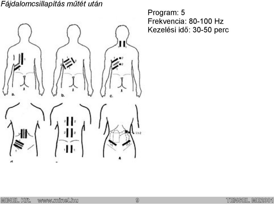 Hz Kezelési idő: 30-50 perc