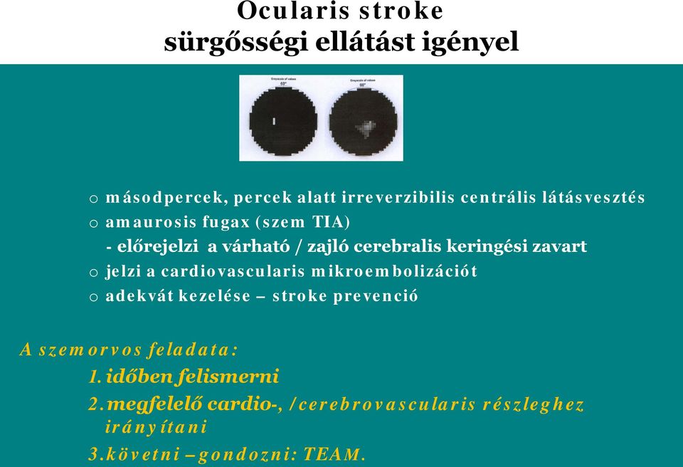 o jelzi a cardiovascularis mikroembolizációt o adekvát kezelése stroke prevenció A szemorvos