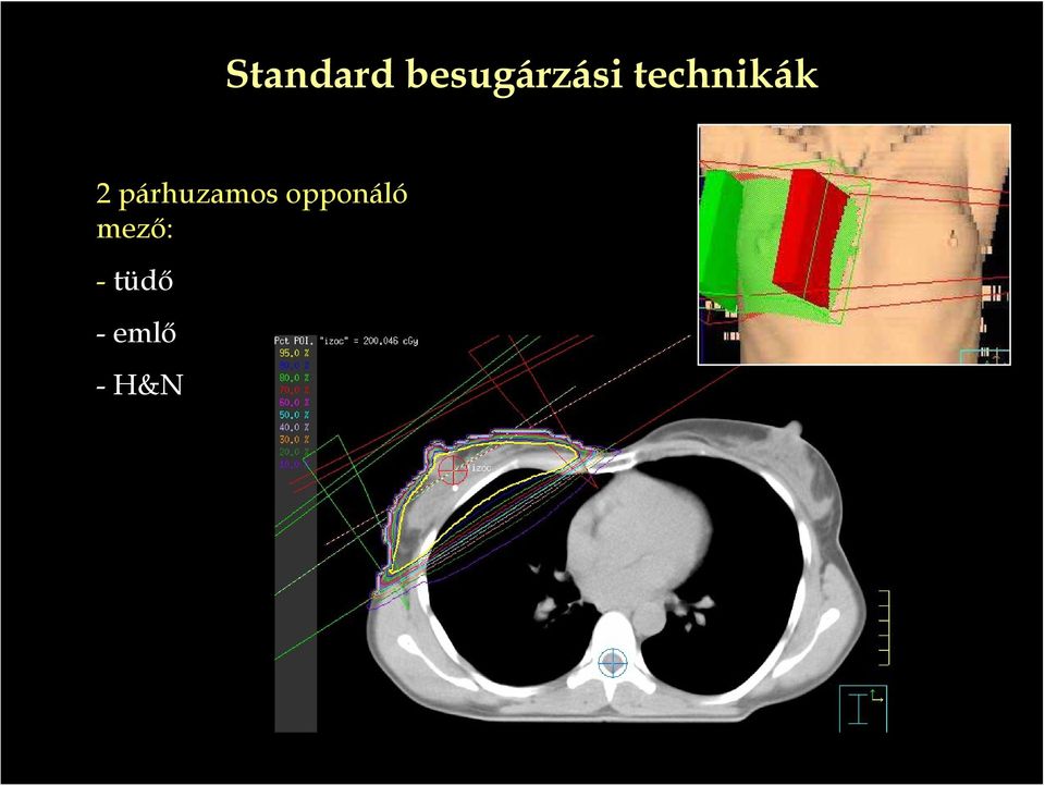 technikák 2