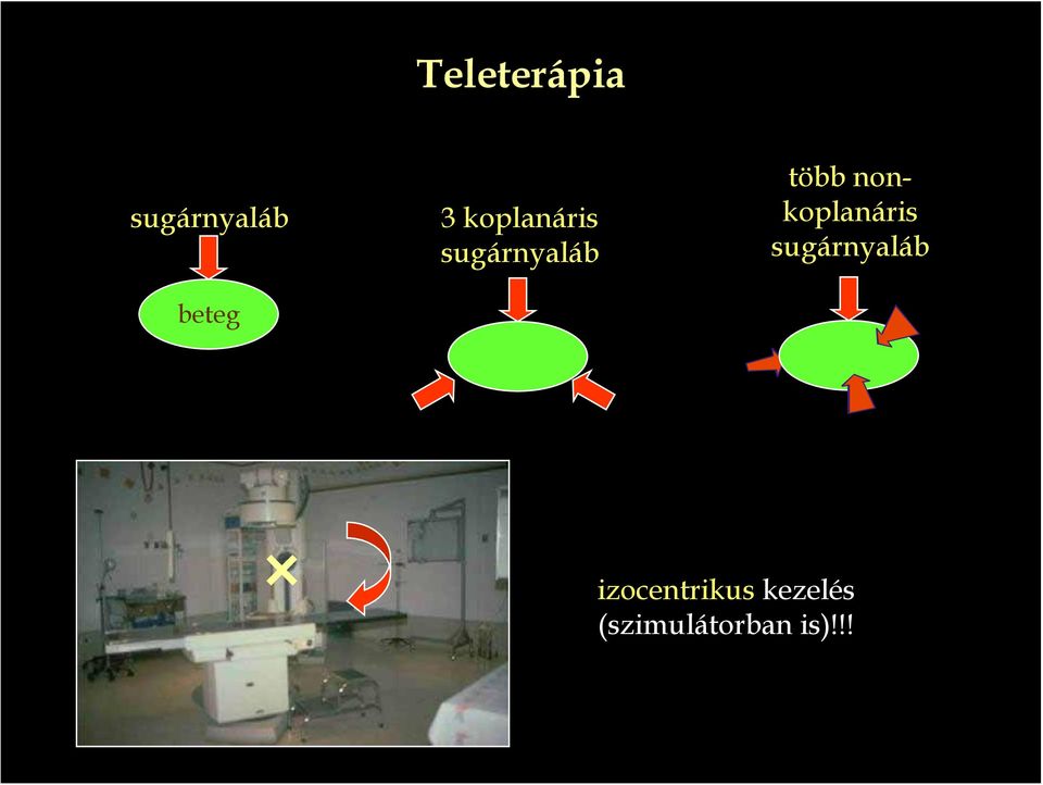 nonkoplanáris sugárnyaláb