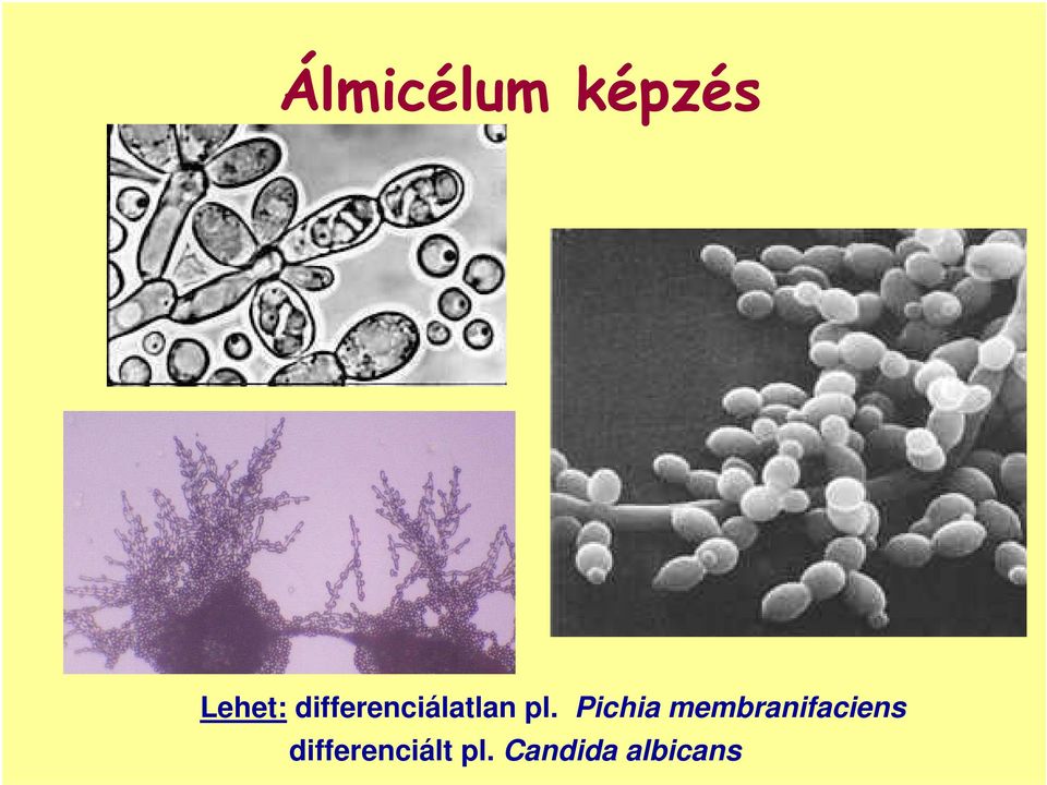 Pichia membranifaciens