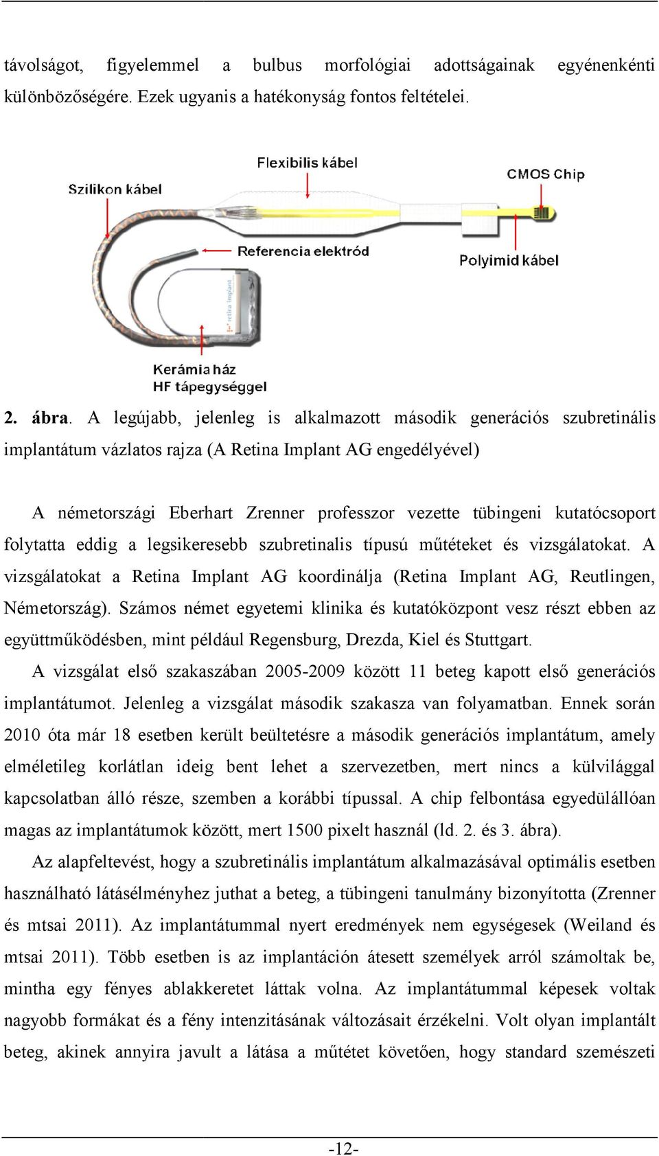 kutatócsoport folytatta eddig a legsikeresebb szubretinalis típusú műtéteket és vizsgálatokat. A vizsgálatokat a Retina Implant AG koordinálja (Retina Implant AG, Reutlingen, Németország).