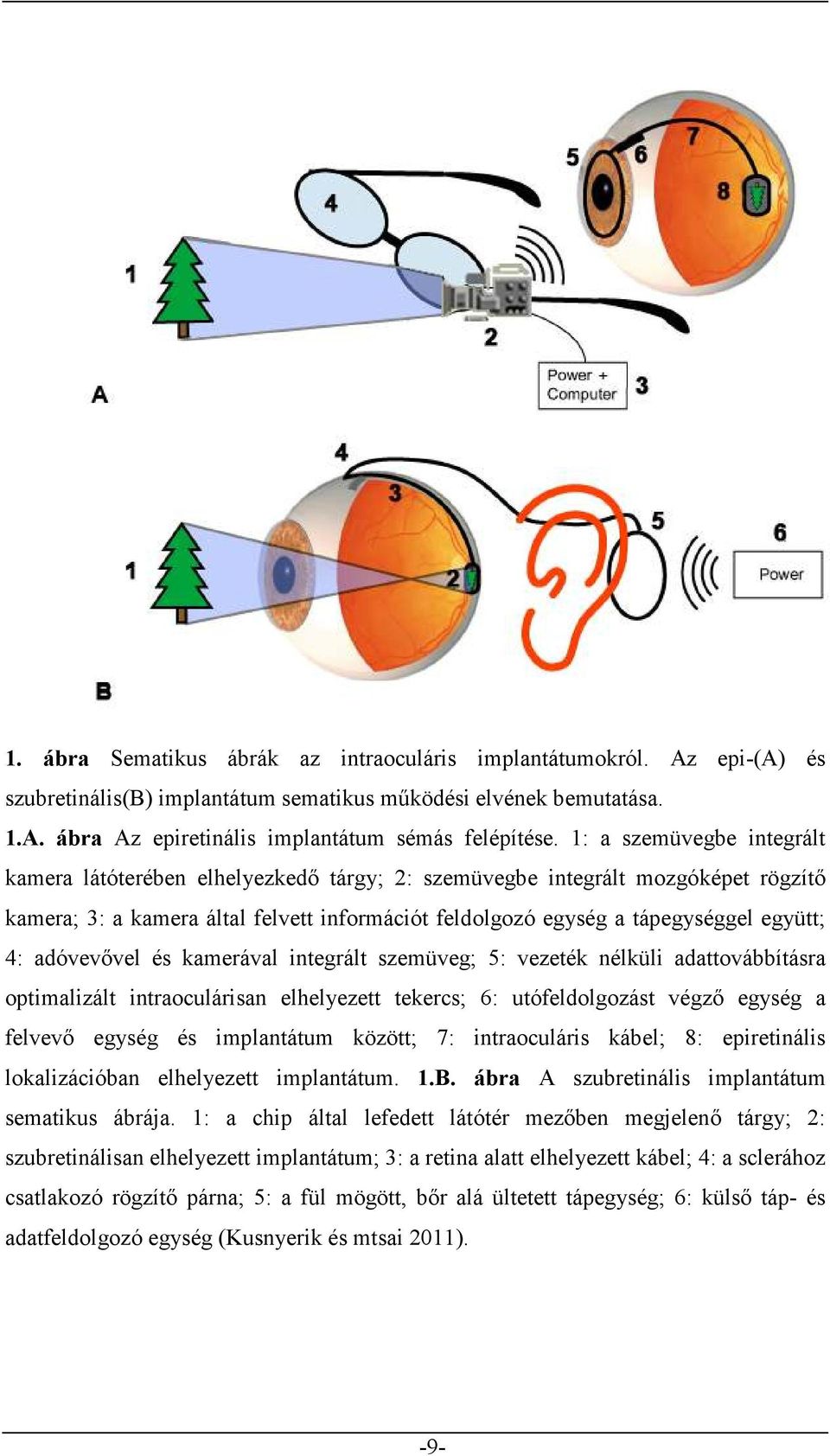 adóvevővel és kamerával integrált szemüveg; 5: vezeték nélküli adattovábbításra optimalizált intraoculárisan elhelyezett tekercs; 6: utófeldolgozást végző egység a felvevő egység és implantátum