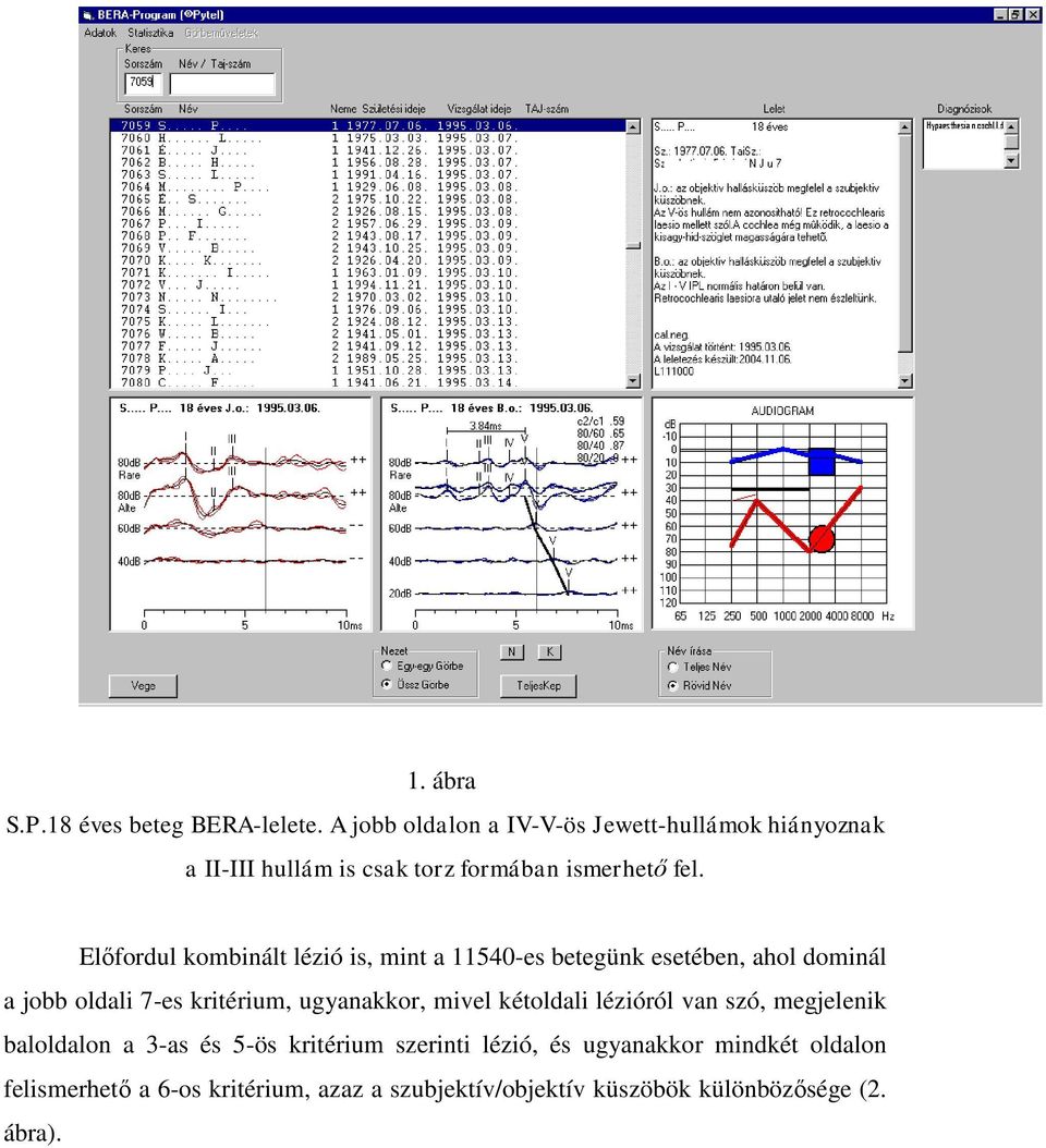 Előfordul kombinált lézió is, mint a 11540-es betegünk esetében, ahol dominál a jobb oldali 7-es kritérium, ugyanakkor,