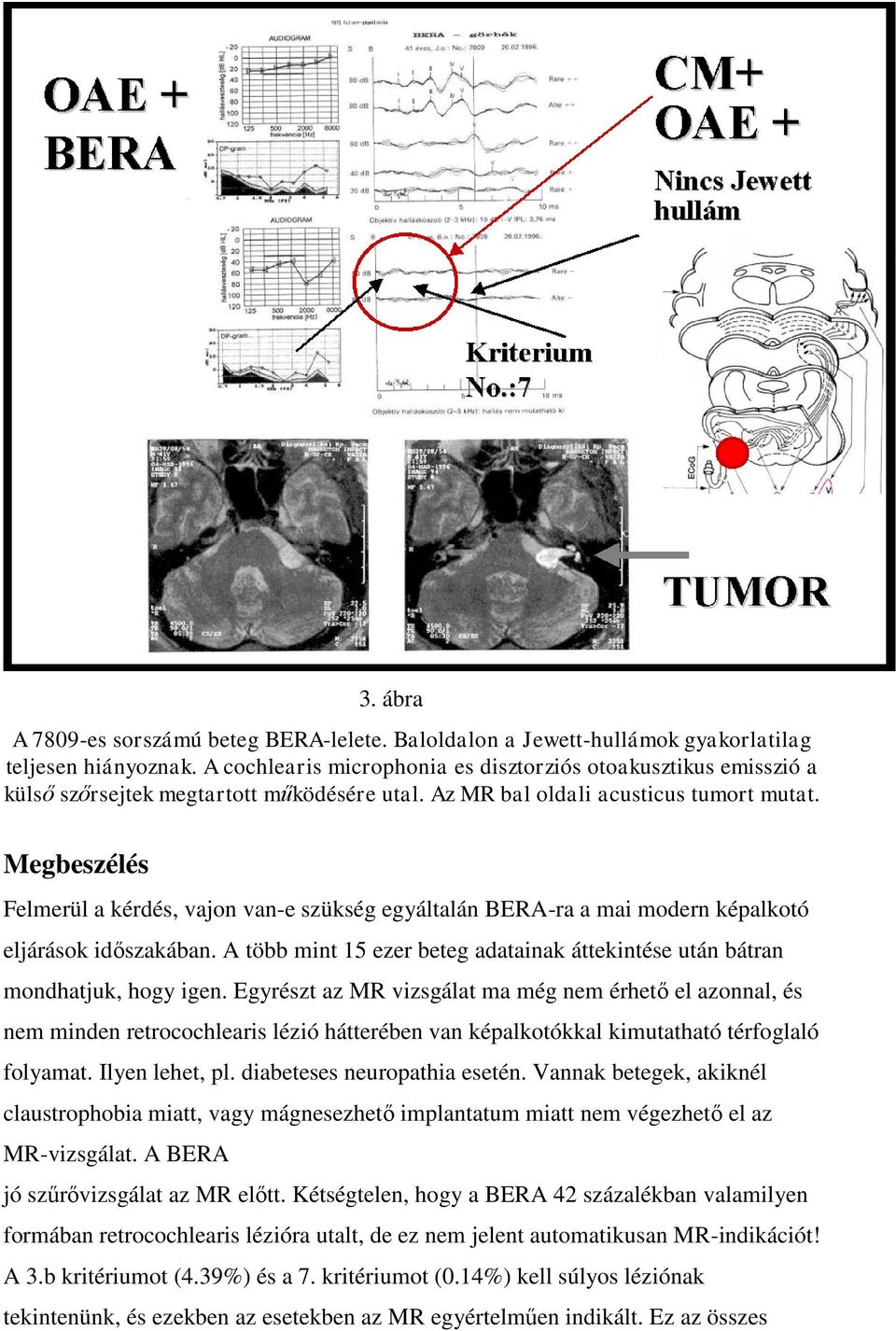 Megbeszélés Felmerül a kérdés, vajon van-e szükség egyáltalán BERA-ra a mai modern képalkotó eljárások időszakában. A több mint 15 ezer beteg adatainak áttekintése után bátran mondhatjuk, hogy igen.