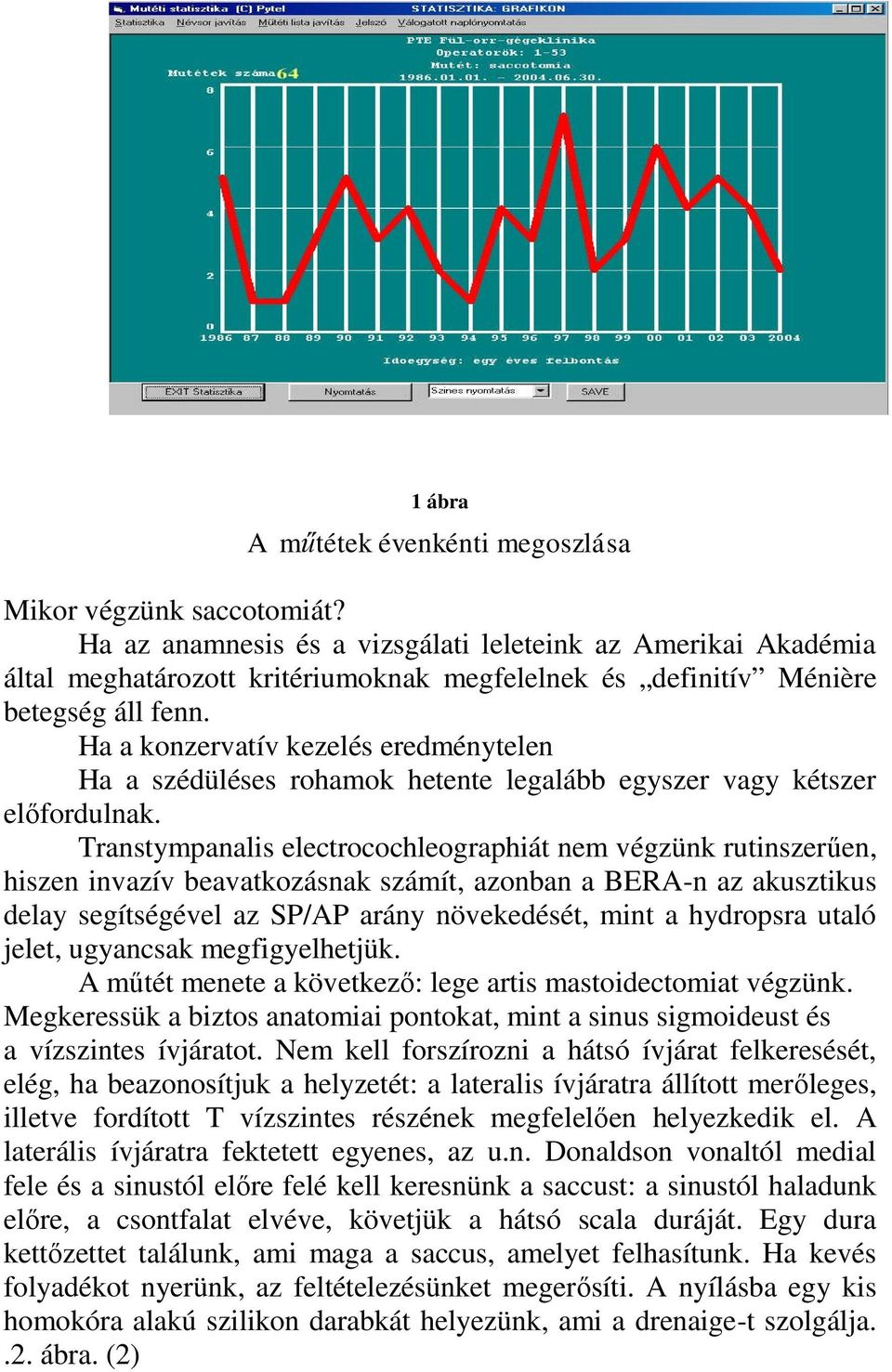 Ha a konzervatív kezelés eredménytelen Ha a szédüléses rohamok hetente legalább egyszer vagy kétszer előfordulnak.