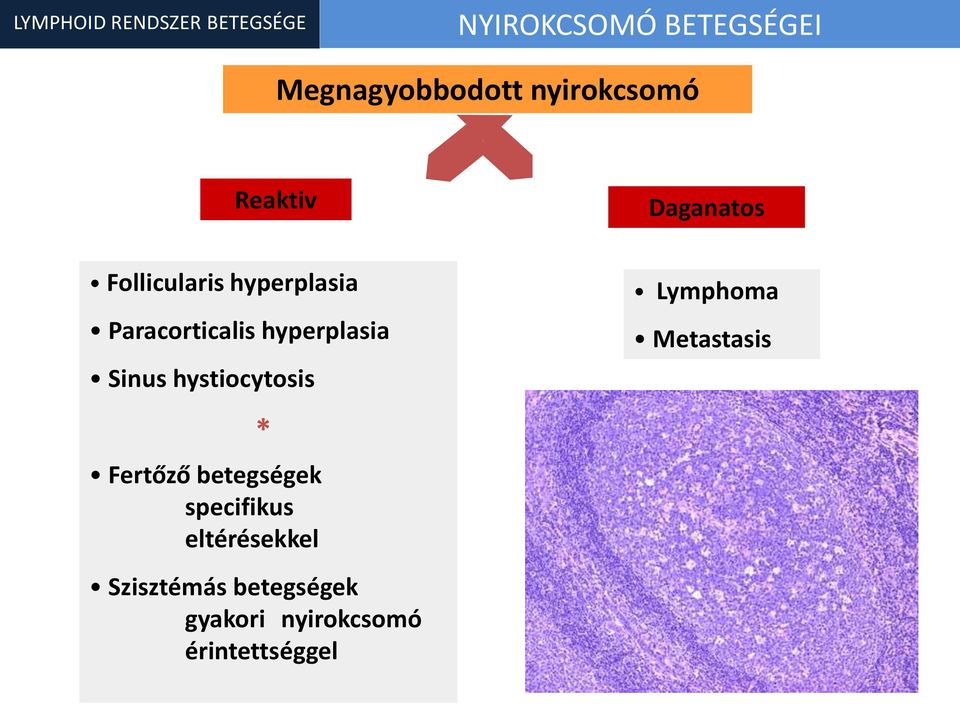 hyperplasia Sinus hystiocytosis * Fertőző betegségek specifikus