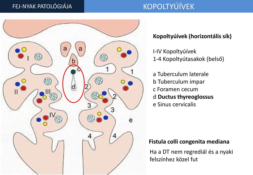 Tuberculum impar c Foramen cecum d Ductus thyreoglossus e Sinus