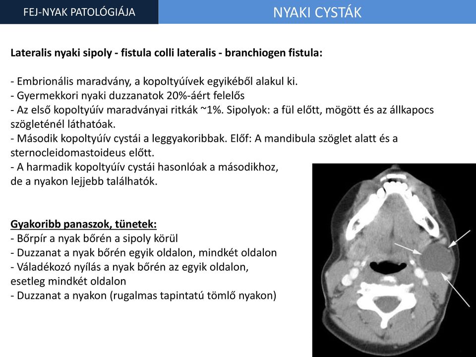 - Második kopoltyúív cystái a leggyakoribbak. Előf: A mandibula szöglet alatt és a sternocleidomastoideus előtt.