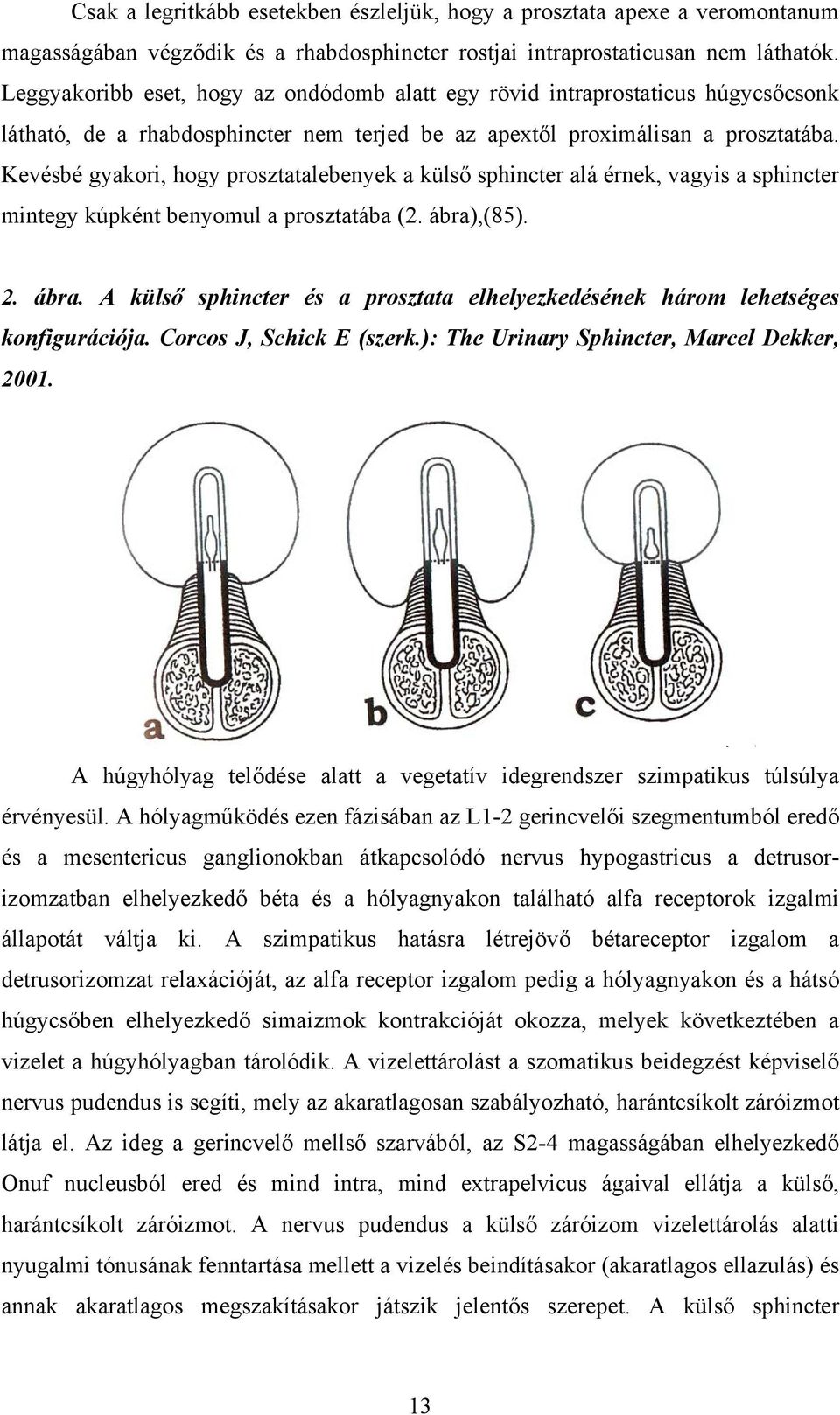 Kevésbé gyakori, hogy prosztatalebenyek a külső sphincter alá érnek, vagyis a sphincter mintegy kúpként benyomul a prosztatába (2. ábra)