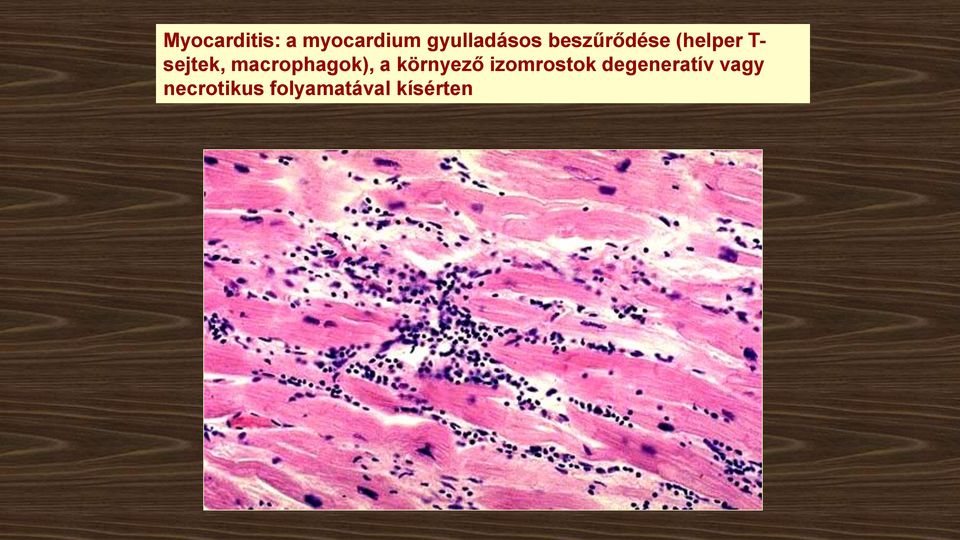 macrophagok), a környező izomrostok