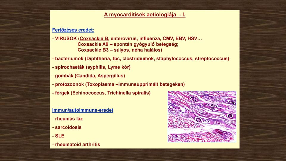 Coxsackie B3 súlyos, néha halálos) - bacteriumok (Diphtheria, tbc, clostridiumok, staphylococcus, streptococcus) - spirochaeták