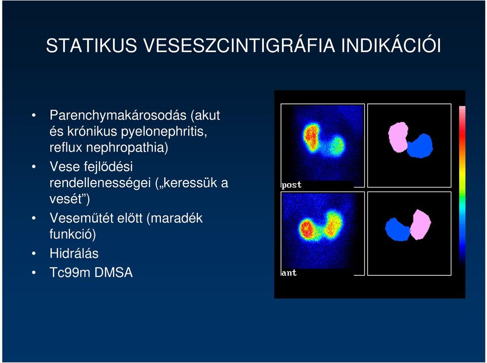 reflux nephropathia) Vese fejlıdési rendellenességei (