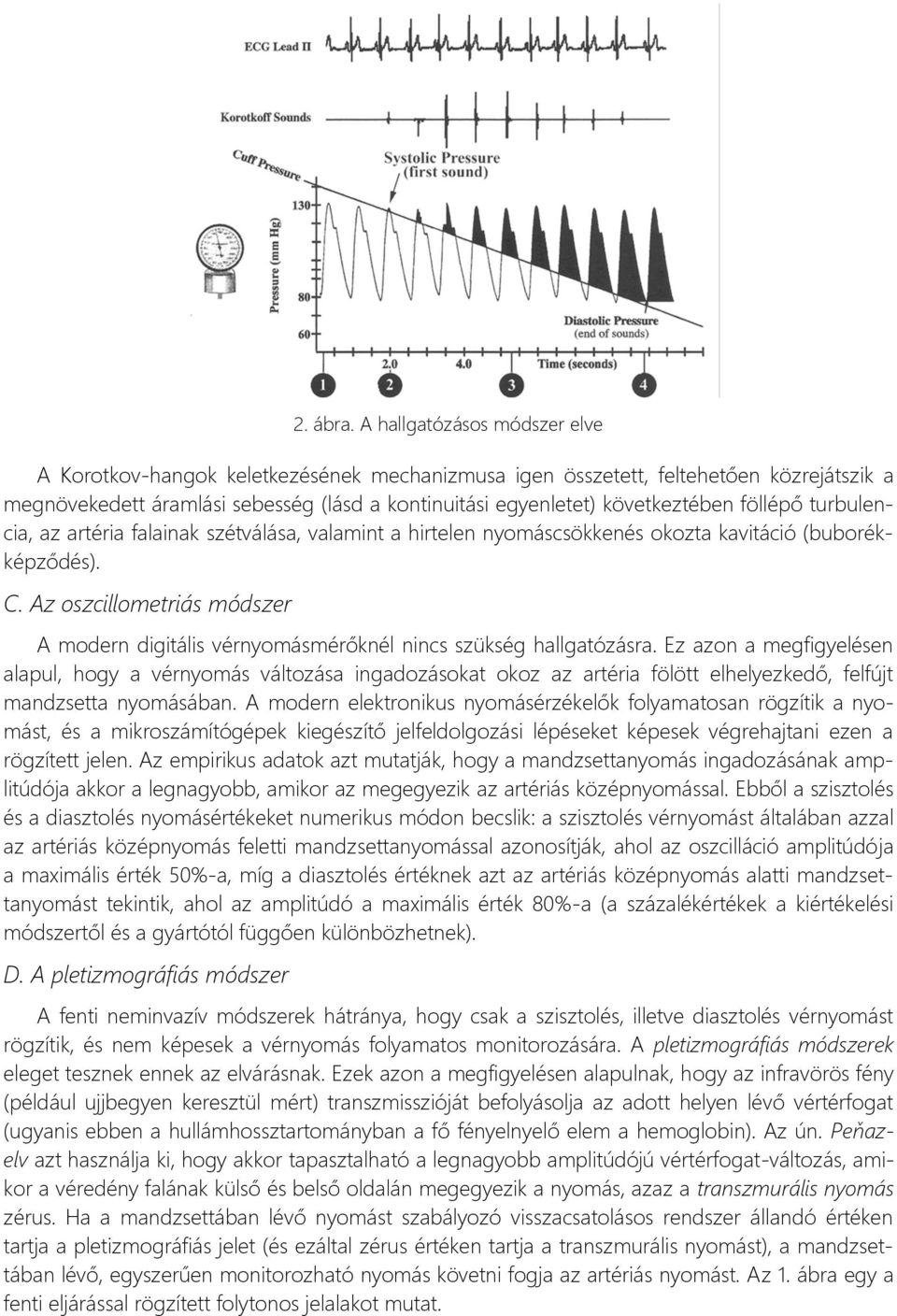 föllépő turbulencia, az artéria falainak szétválása, valamint a hirtelen nyomáscsökkenés okozta kavitáció (buborékképződés). C.