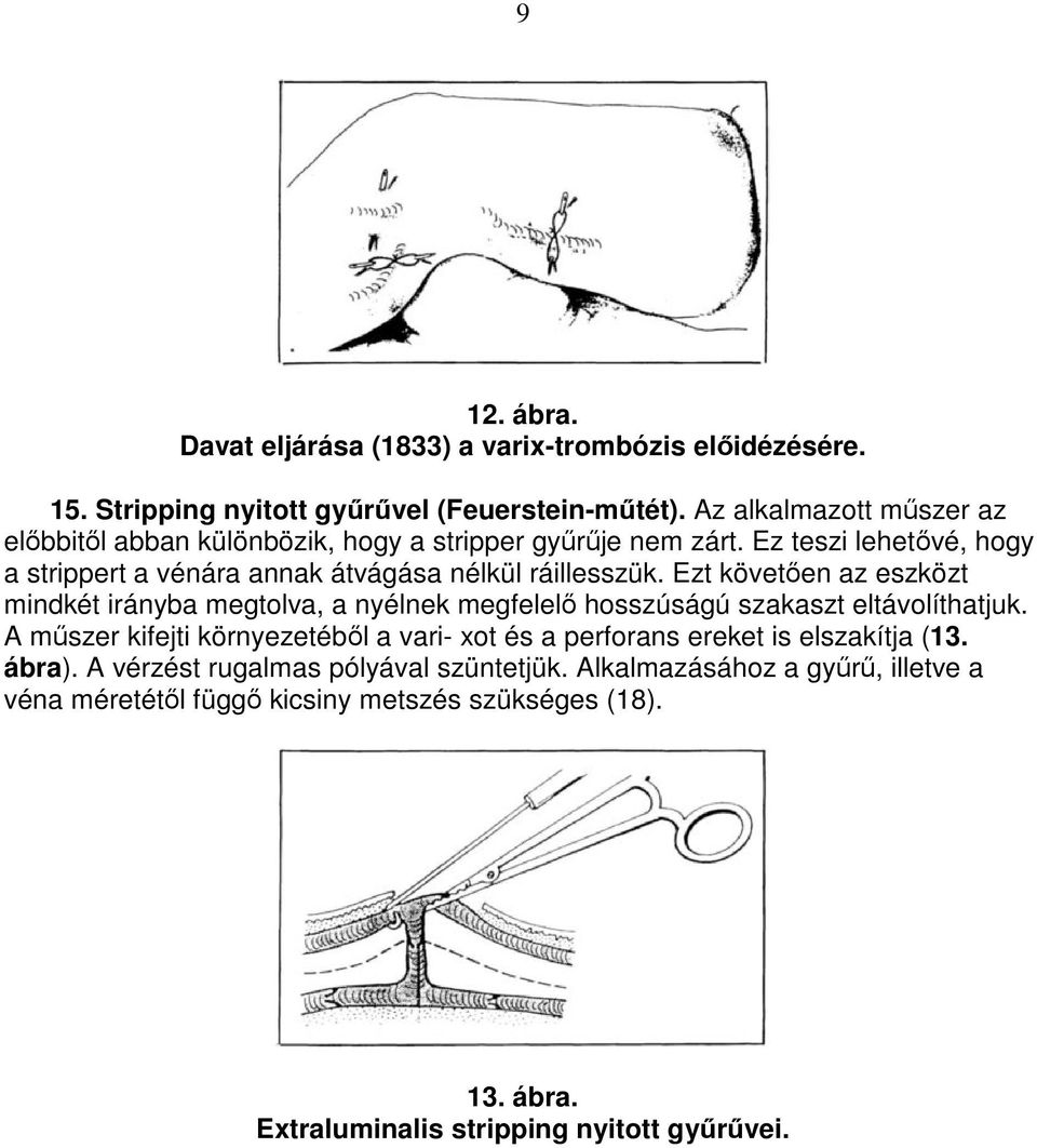 Ezt követıen az eszközt mindkét irányba megtolva, a nyélnek megfelelı hosszúságú szakaszt eltávolíthatjuk.