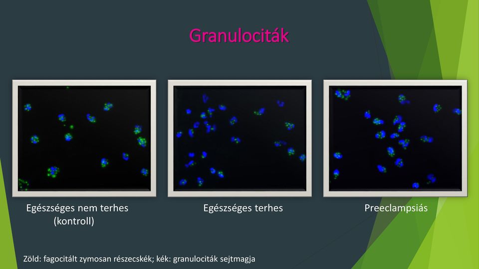 (kontroll) Zöld: fagocitált zymosan