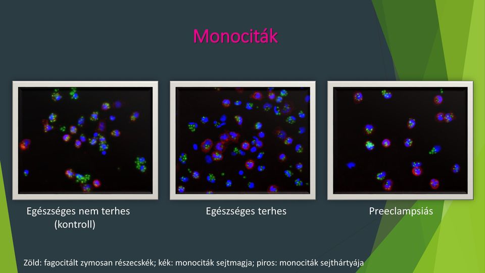 (kontroll) Zöld: fagocitált zymosan