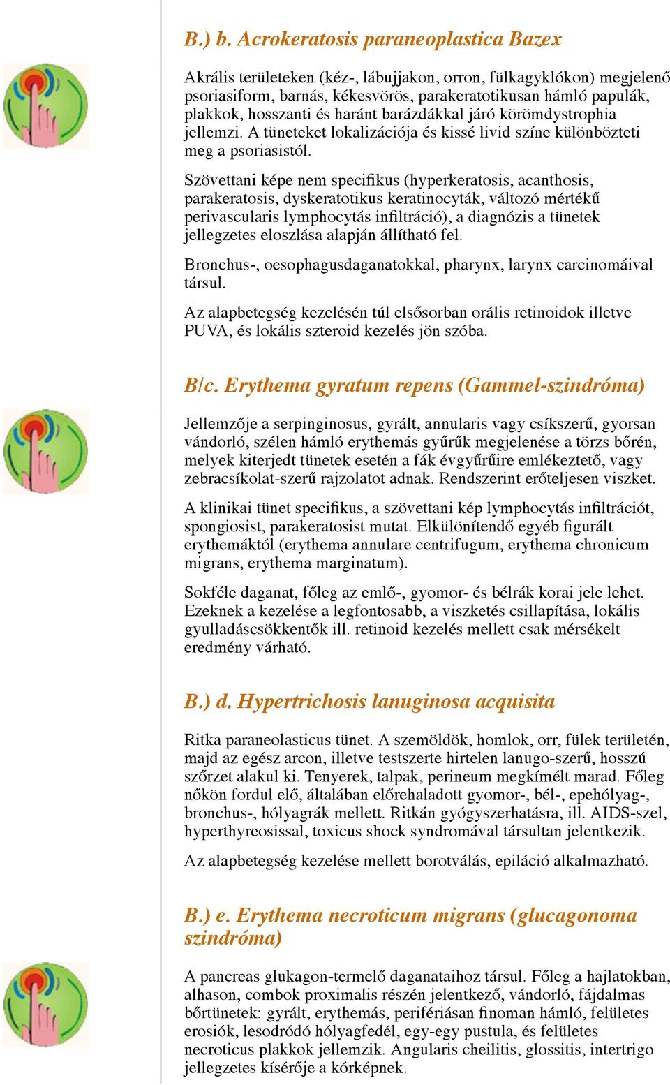 haránt barázdákkal járó körömdystrophia jellemzi. A tüneteket lokalizációja és kissé livid színe különbözteti meg a psoriasistól.