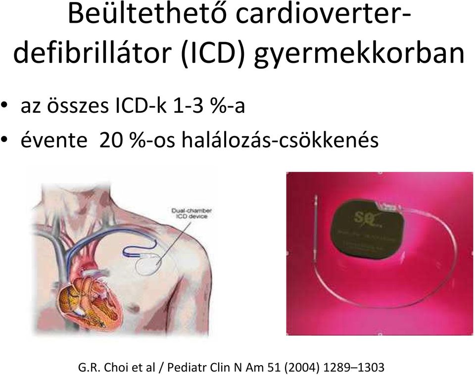 évente 20 %-os halálozás-csökkenés G.R.