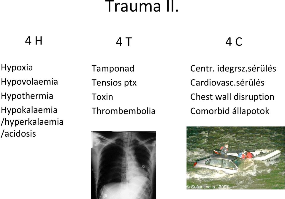 Hypokalaemia /hyperkalaemia /acidosis Tamponad Tensios