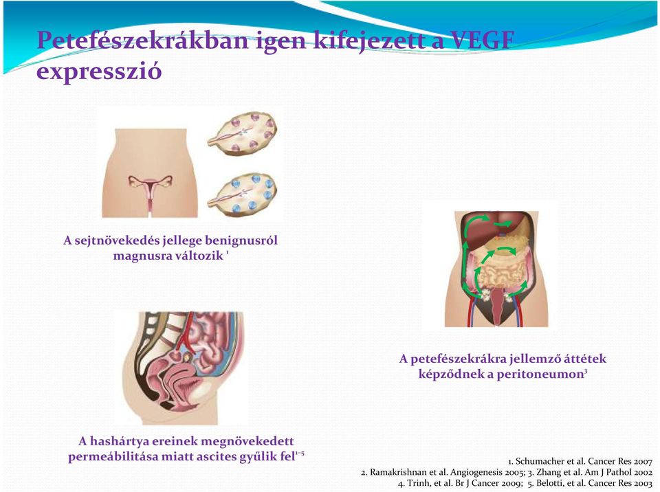 permeábilitása miatt ascitesgyűlik fel 1 5 1. Schumacher et al. Cancer Res 2007 2. Ramakrishnan et al.