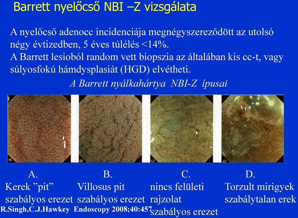 A Barrett lesioból random vett biopszia az általában kis cc-t, vagy súlyosfokú hámdysplasiát (HGD) elvétheti.