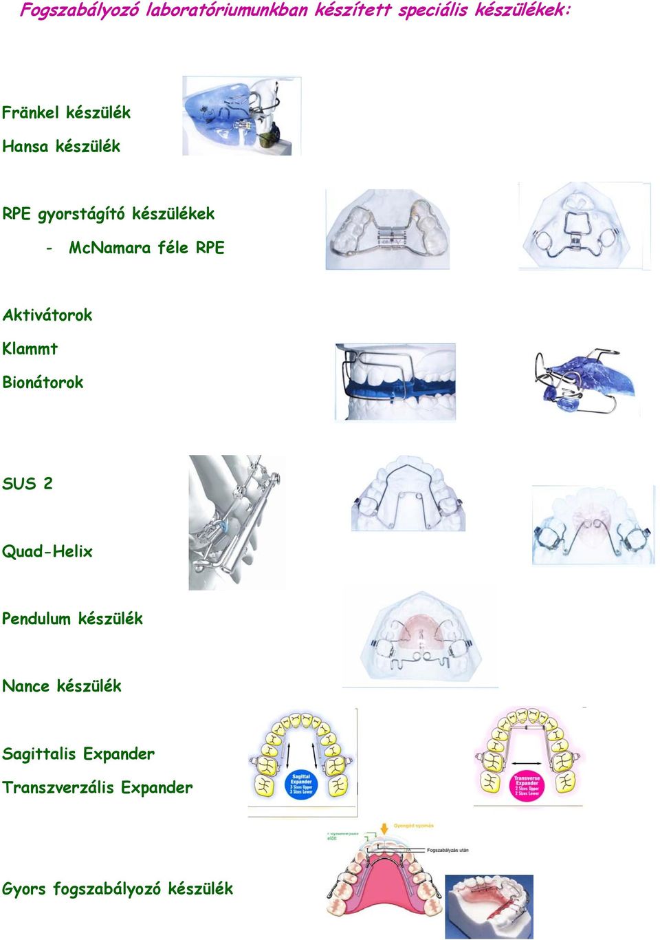 Aktivátorok Klammt Bionátorok SUS 2 Quad-Helix Pendulum készülék Nance