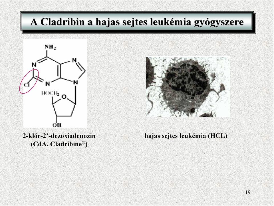 2-klór-2 -dezoxiadenozin (CdA,