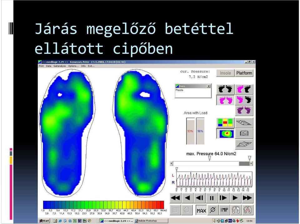 cipőben A Medilogic