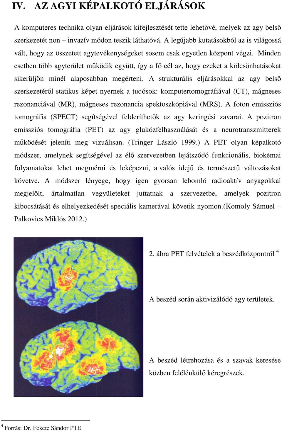 Minden esetben több agyterület mőködik együtt, így a fı cél az, hogy ezeket a kölcsönhatásokat sikerüljön minél alaposabban megérteni.