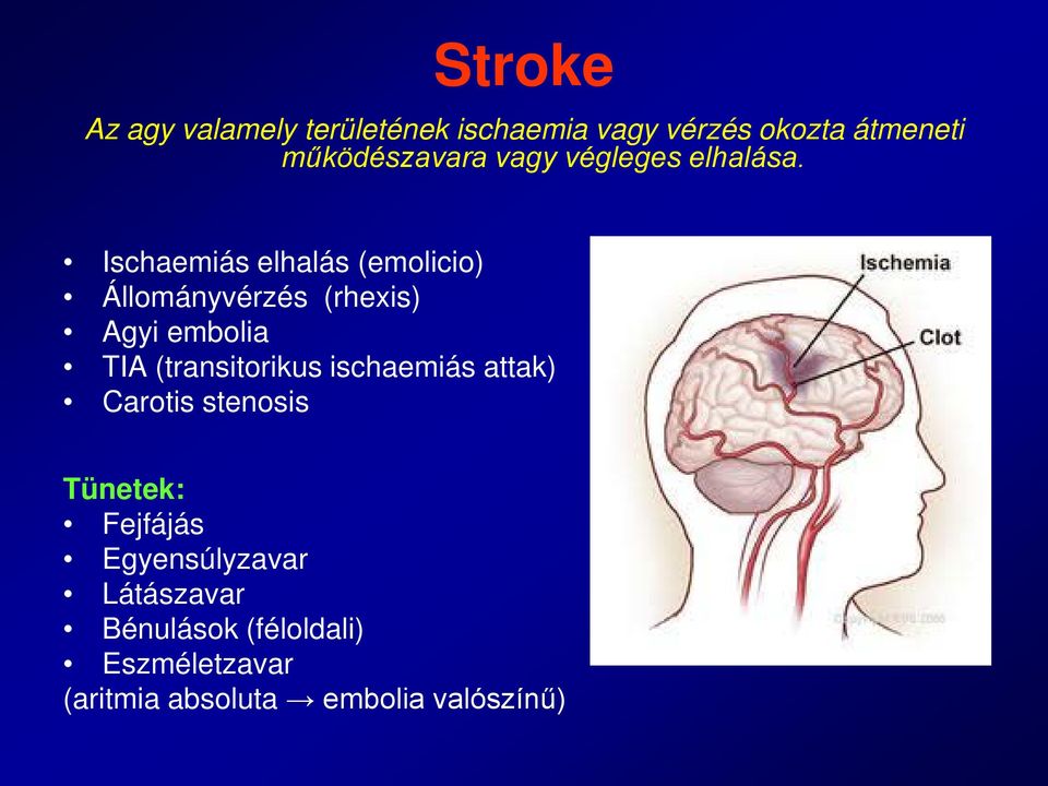 Ischaemiás elhalás (emolicio) Állományvérzés (rhexis) Agyi embolia TIA (transitorikus