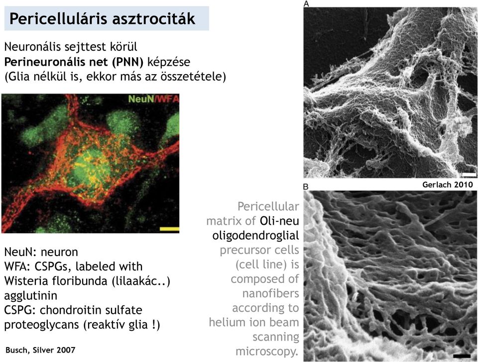 .) agglutinin CSPG: chondroitin sulfate proteoglycans (reaktív glia!