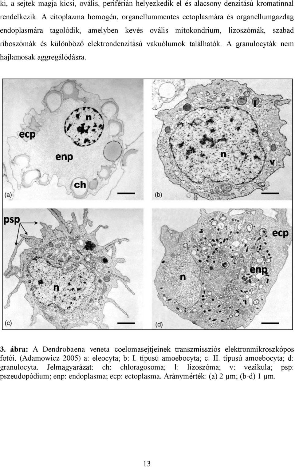 elektrondenzitású vakuólumok találhatók. A granulocyták nem hajlamosak aggregálódásra. 3. ábra: A Dendrobaena veneta coelomasejtjeinek transzmissziós elektronmikroszkópos fotói.