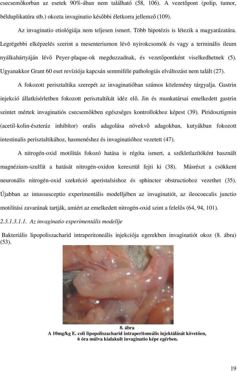 Legrégebbi elképzelés szerint a mesenteriumon lévı nyirokcsomók és vagy a terminális ileum nyálkahártyáján lévı Peyer-plaque-ok megduzzadnak, és vezetıpontként viselkedhetnek (5).